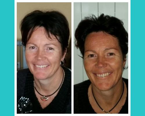 après une séance de lifting facial
luminosité et fraicheur retrouvée