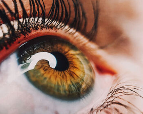 EMDR