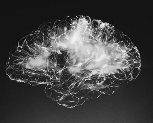 Neurofeedback